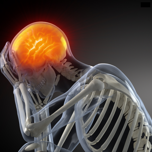 Chiropractic Sports Injuries (ICSC) #01 of 10: Head Injuries in Sport