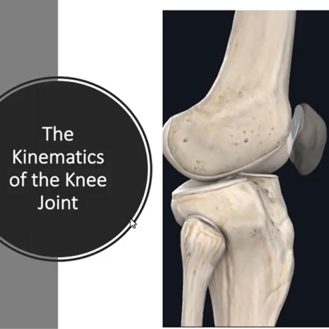 MASTERCLASS – Patellofemoral (Dr Christine Foss)