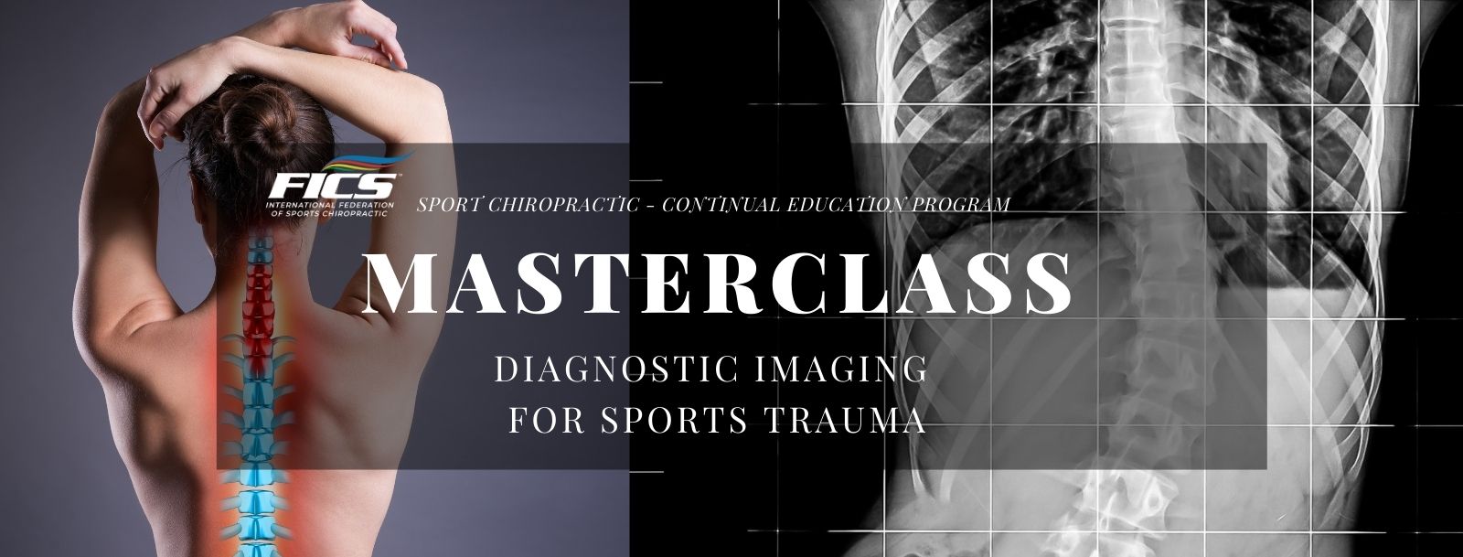 MASTERCLASS – Diagnostic Imaging for Sports Trauma (Professor Chad Warshel)